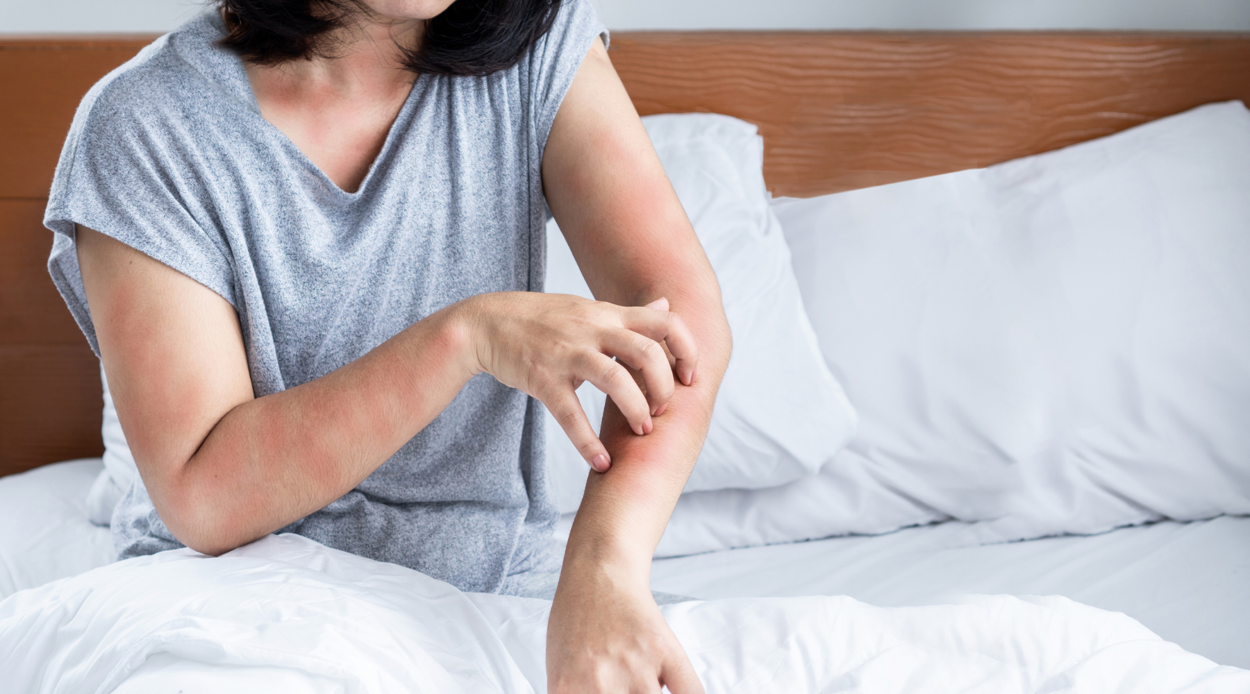 How Linen Supports Sensitive Skin: A Guide for Allergy Sufferers